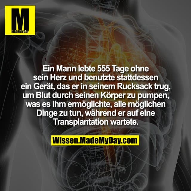 Ein Mann lebte 555 Tage ohne sein Herz und benutzte stattdessen ein Gerät, das er in seinem Rucksack trug, um Blut durch seinen Körper zu pumpen, was es ihm ermöglichte, alle möglichen Dinge zu tun, während er auf eine Transplantation wartete. - Inspiration, Zitate & Sprüche | MadeMyDay | Jetzt entdecken & teilen Ein Mann lebte 555 Tage ohne sein Herz und benutzte stattdessen ein Gerät, das er in seinem Rucksack trug, um Blut durch seinen Körper zu pumpen, was es ihm ermöglichte, alle möglichen Dinge zu tun, während er auf eine Transplantation wartete. - Inspirierendes Zitat mit Bild